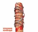 چوب بیسبال خاردار(لوسیل)